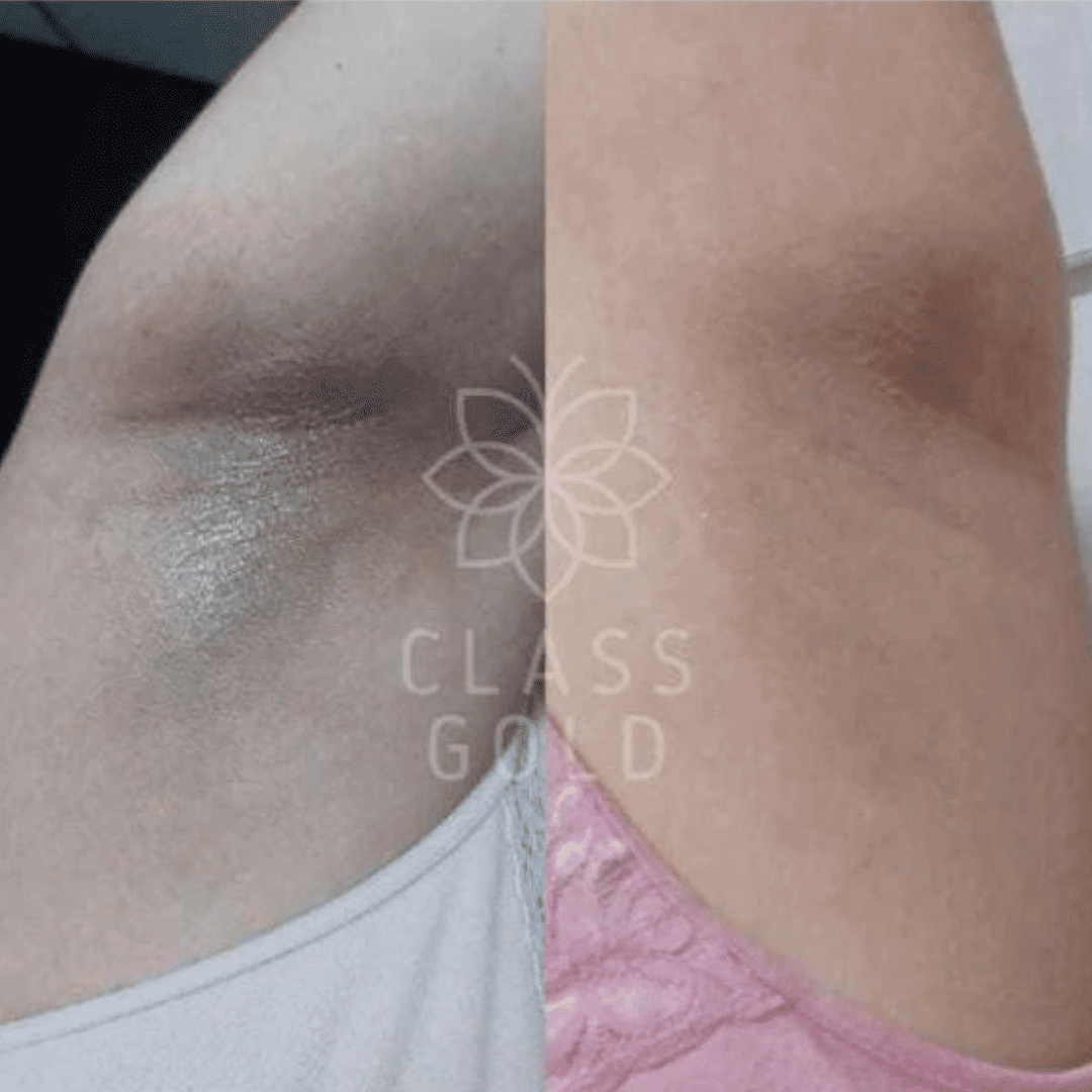 CREMA DERMOACLARANTE CORPORAL - Imagen 4
